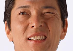 自毛植毛の全貌と費用の真実：成功する施術のための完全ガイド